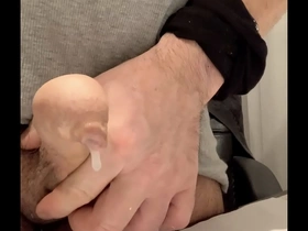 Phimosis cum